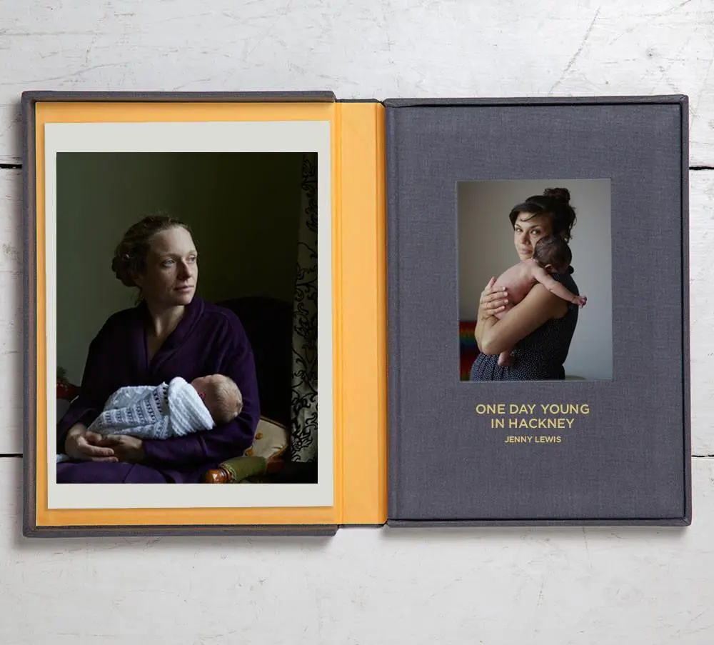 Collector's Edition + Print: One Day Young In Hackney 1
